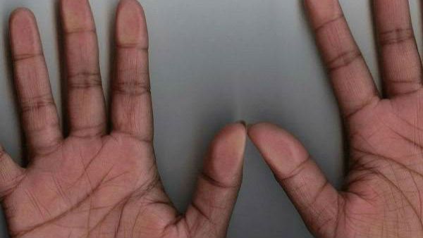 હથેળીમાં માછલી