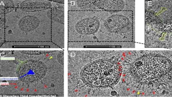 પહેલીવાર સામે આવ્યો કોરોના વાયરસનો અસલી ચહેરો, જુઓ કેટલો ખતરનાક છે આ વાયરસ
