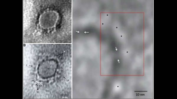 ચીનના વુહાનથી મહિલા દર્દી પરત ફરી હતી