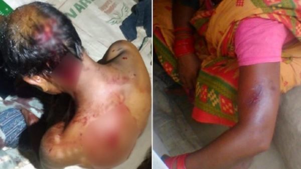 મજૂરે ઘરે જવા કહ્યુ તો માલિકે બેરહેમીથી માર્યો, ફોટામાં જુઓ નિર્દયતા