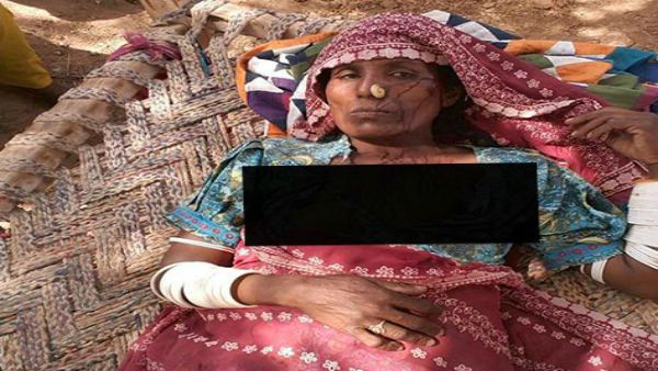 હિંદુ વિરોધી હિંસાના ફોટા પશ્ચિમ બંગાળના ગણાવીને વાયરલ કર્યા હિંદુ વિરોધી હિંસાના ફોટા પશ્ચિમ બંગાળના ગણાવીને વાયરલ કર્યા