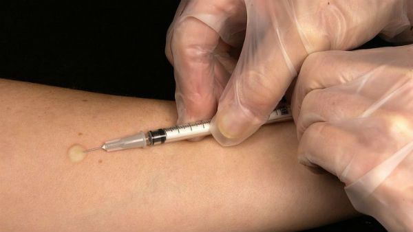 સીરમ હોય શકે શ્રેષ્ઠ ઈલાજ