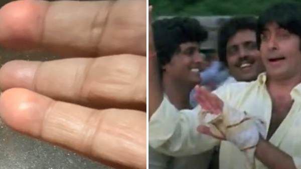 દિવાળીમાં બળી ગયો હતો અમિતાભનો હાથ, રૂમાલ બાંધીને કર્યુ કામ, જુઓ ફોટા