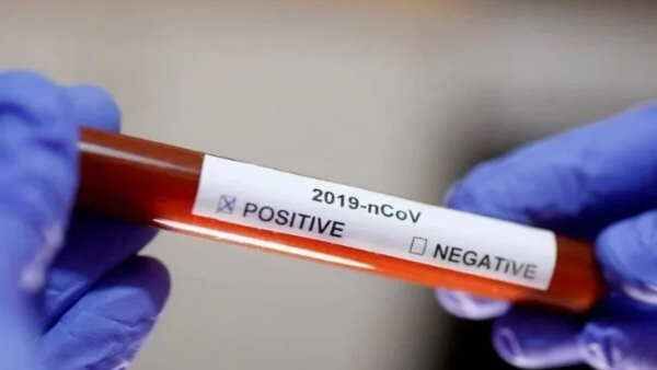 આ ગાઈડલાન્સનુ પાલન જરૂરી