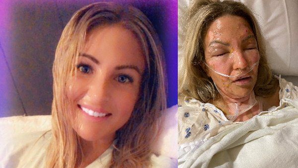 દિવ્યાંગ દીકરી અને પાલતુ જાનવરને બચાવવામાં રહી સફળ