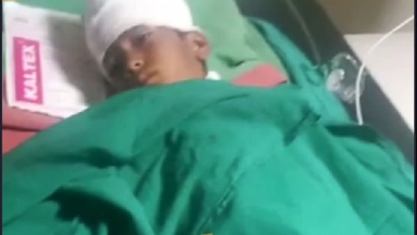 અમદાવાદઃ મોત સામે જંગ, 8 વર્ષના બાળક પર 5 કુતરાઓએ હુમલો કર્યો