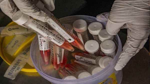 વાયર લોડ