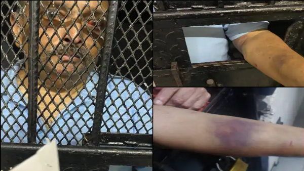 ડોમિનિકકા જેલમાં કેદ મેહુલ ચોક્સીની પહેલી તસવીર સામે આવી, શરીર પર દેખાયા મારપીટના નિશાન