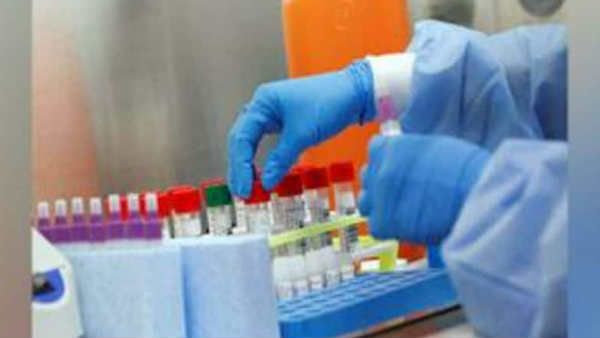 સેલાઈન ગાર્ગલ આરટી-પીસીઆર પદ્ધતિ