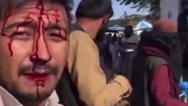 માણસે બૂમો પાડી- 'તેમણે મને માર્યો ...'