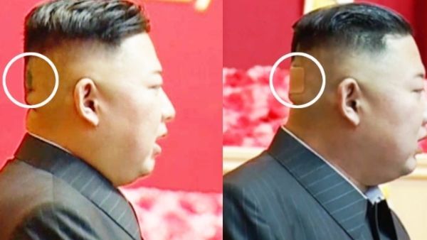 કિમ જોંગ ઉનને કોણે કર્યો ઇજાગ્રસ્ત, કે બીમાર છે ઉત્તર કોરિયાનો સરમુખત્યાર?