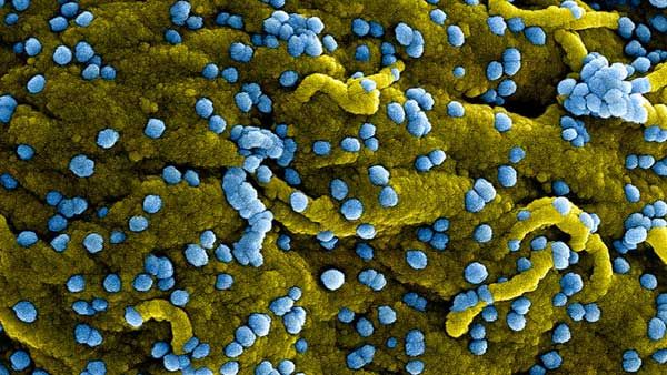 કેવી રીતે સારવાર થાય છે? કેવી રીતે સારવાર થાય છે?