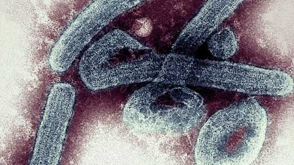 વાયરસના લક્ષણો કેવા છે? વાયરસના લક્ષણો કેવા છે?