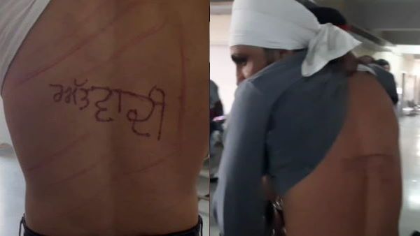 પંજાબઃ જેલ અધિકારીઓએ કેદીની પીઠ પર ગરમ સળિયાથી લખ્યુ આતંકવાદી, સરકારે આપ્યા તપાસના આદેશ