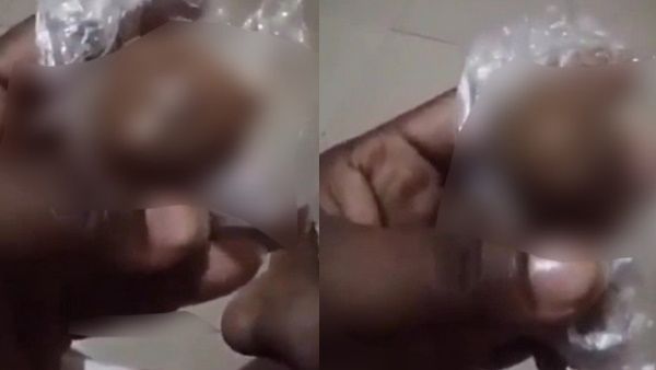 માણસના લિંગ જેવી ચીજ નિકળી માણસના લિંગ જેવી ચીજ નિકળી