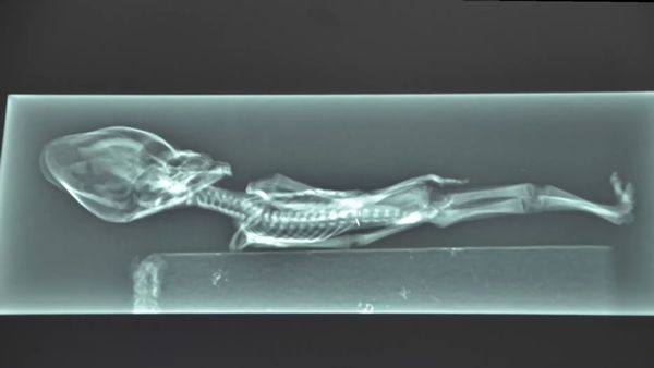 પાંસળી પણ માણસો કરતાં નાની