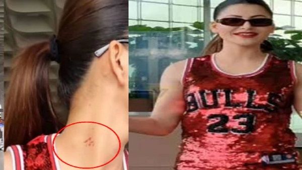 ઉર્વશી રૌતેલાના ગળા પર લવ બાઈટ કે બીજુ કંઈ? પુછવા પર કંઈક આવી રીતે ભડકી!