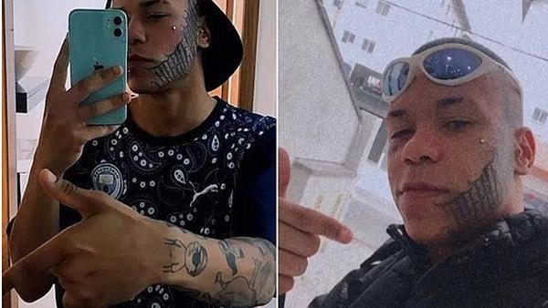 ભૂતપૂર્વ બોયફ્રેન્ડે છોકરીના ચહેરા પર બનાવ્યું ટેટૂ