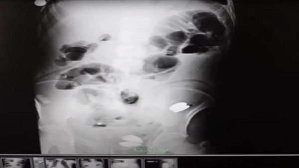 પહેલા ક્યારેય નથી કરી આવી સર્જરી