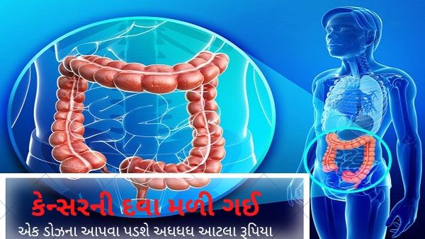 કેન્સરના ઈતિહાસમાં પહેલીવાર મળી ઐતિહાસિક સફળતા, ક્લિનિકલ ટ્રાયલ દરમિયાન દવા 100% અસરકારક
