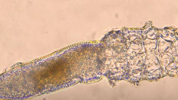 સ્કિન માઈટ્સની 48 હજાર પ્રજાતિઓ છે