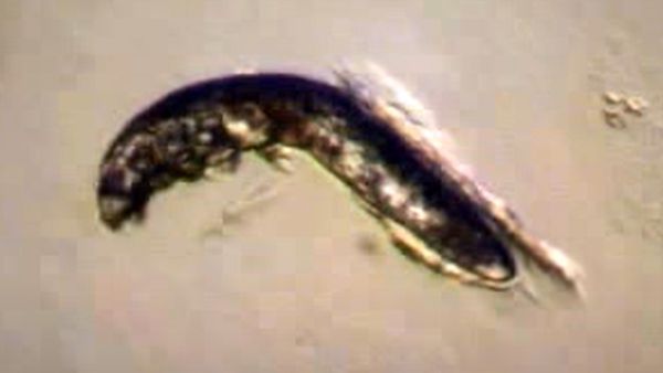 માણસની રૂવાડી સાથે ચોંટી સેક્સ કરે છે