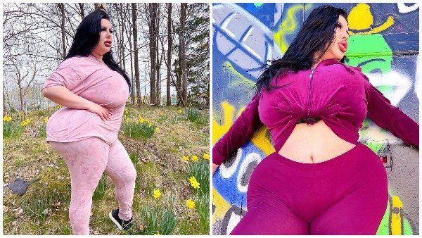 1 કરોડ રૂપિયાથી વધુની સર્જરી કરાવી