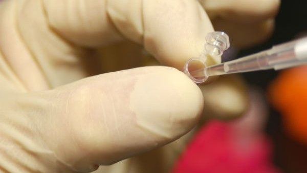 મહિલાએ મજાકમાં કરાવ્યો DNA ટેસ્ટ, રિપોર્ટ આવ્યા બાદ પરિવારના ઉડી ગઇ હોશ