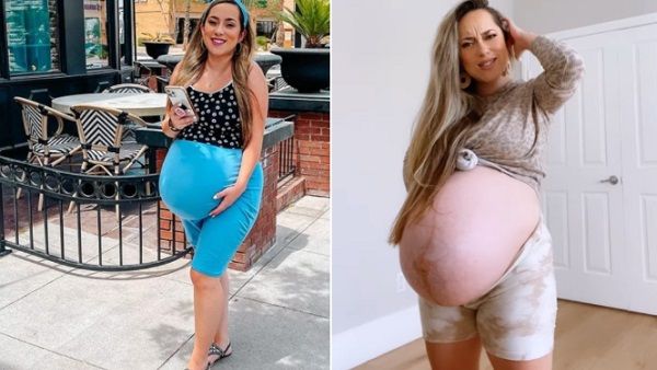 દરેકની પ્રેગ્નેન્સી અલગ હોય છે દરેકની પ્રેગ્નેન્સી અલગ હોય છે