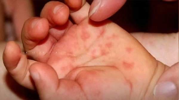 લક્ષણ લક્ષણ