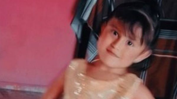 આ રોગથી પીડિત હતી બાળકી