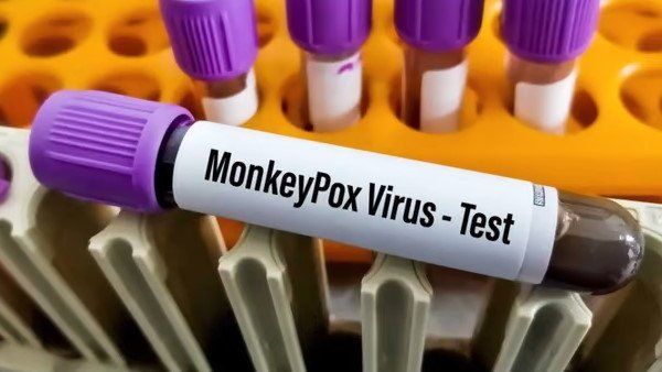 LNJP હોસ્પિટલમાં દાખલ