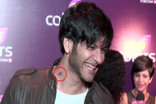 અલી ફઝલ અલી ફઝલ