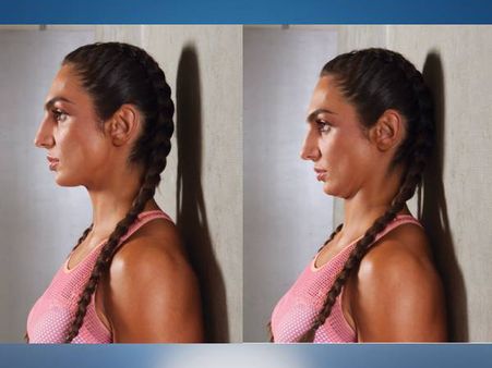 1. ચિન ટક 1. ચિન ટક