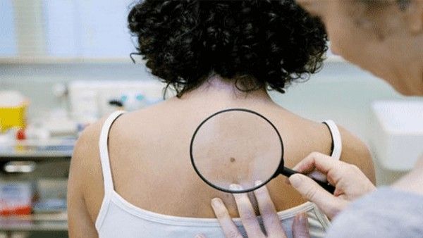 કેન્સરના જોખમને ઘટાડવા માટે શું કરવુ