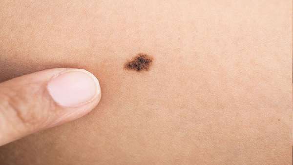 તલના આકારનુ પણ મહત્વ