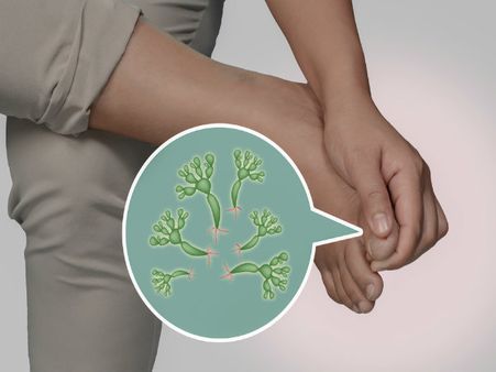 એડી ફાટી જવાની સમસ્યા કરે છે દૂર