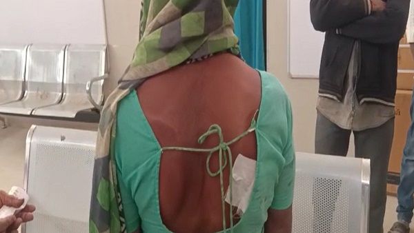 ઝઘડિયાના વેલુગામે ખેતરમાં મજૂરી કામ કરતી મહિલા પર દીપડાનો જીવલેણ હુમલો