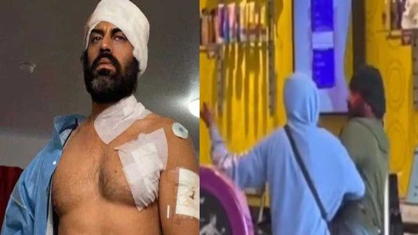 હુમલા બાદ ઘણી જગ્યાએ ટાંકા આવ્યા છે
