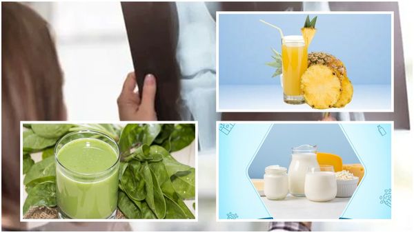 Health care : હાડકાં બનશે મજબૂત, અને ડાયટમાં શામેલ કરો આ ત્રણ વસ્તું