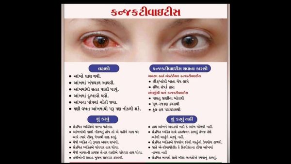 ‘વાઈરલ કનઝંક્ટીવાઈટીસ’થી ગભરાવાની જરૂર નથી પણ,વધુ ફેલાય નહીં તે માટે યોગ્ય સારવાર-સાવચેતી રાખવી જરૂરી