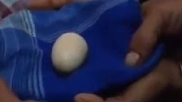 આ છોકરો મરઘીની જેમ ઈંડા આપે છે, 2 વર્ષમાં આપી ચુક્યો છે 20 ઇંડા