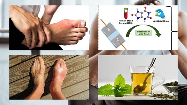 Health News : યુરિક એસિડથી વધી શકે છે સાંધાનો દુઃખાવો, આ રીતે મળશે છુટકારો