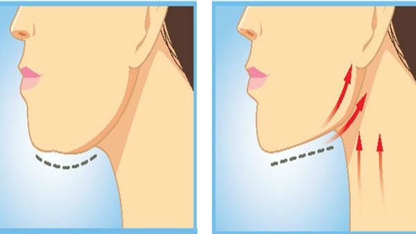 Double chin fat : 1 અઠવાડિયામાં ઘટશે ડબલ ચિન, કરવી પડશે સરળ કસરતો