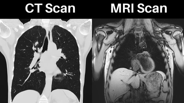 MRI અને CT Scan વચ્ચે શું તફાવત છે? મોટાભાગના લોકો નથી જાણતા