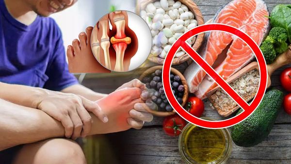 High Uric Acid: યુરિક એસિડની સમસ્યામાંથી મળશે છુટકારો, કરવા પડશે આ સરળ ઉપાય