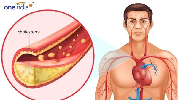 Health Tips: શિયાળામાં વધી જાય છે કોલેસ્ટ્રોલની સમસ્યા, આ ટિપ્સથી મળશે છુટકારો