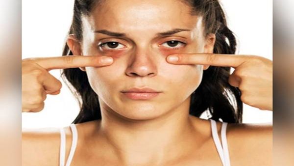 Eye beauty tips: આ ટિપ્સથી દુર થઇ જશે આખોનો સોજો અને કાળા ડાઘ