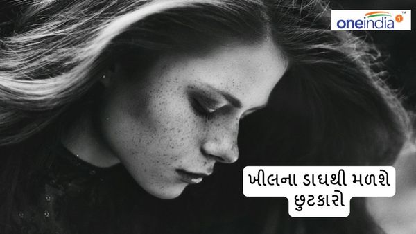 How to get rid From Pimple: ખીલના ડાઘથી મળશે છુટકારો, કરી લો આ ઉપાય