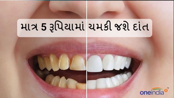 Whiten teeth Remedy: મોતી જેમ ચમકી જશે દાંત, માત્ર 5 રૂપિયામાં ચમકી જશે દાંત